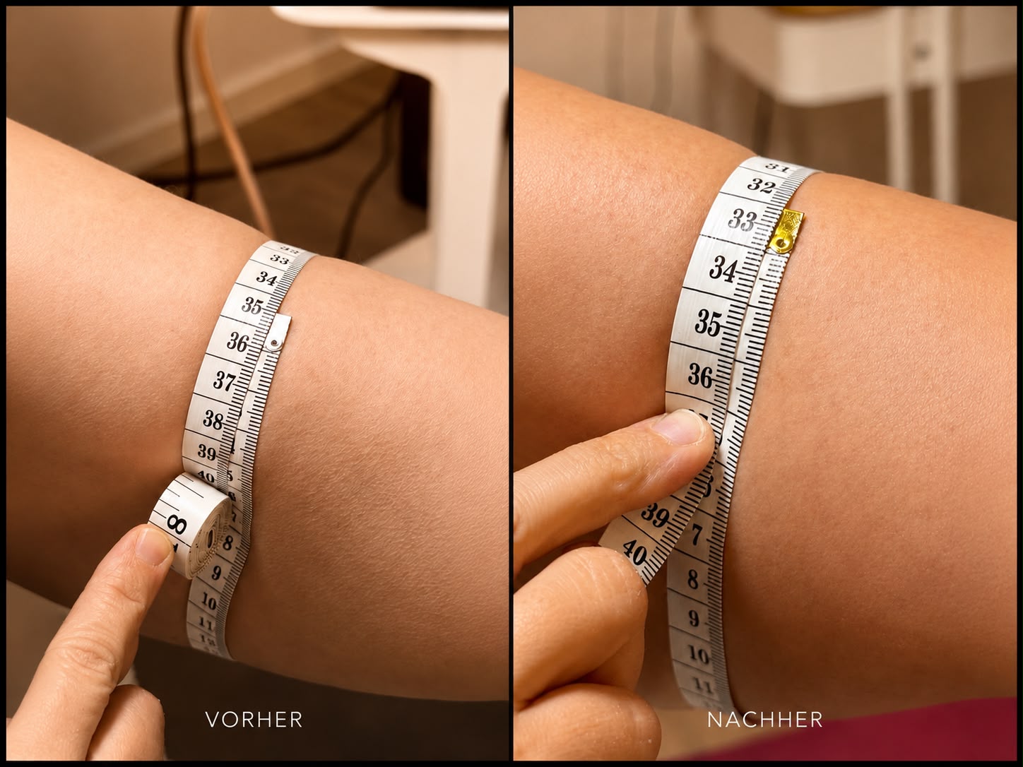 Refit – Vorher/Nachher
